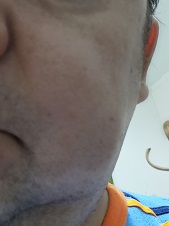 Франц Ирилокин