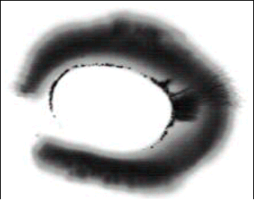 Феномен Джуны. 2. Почему целительство не для всех