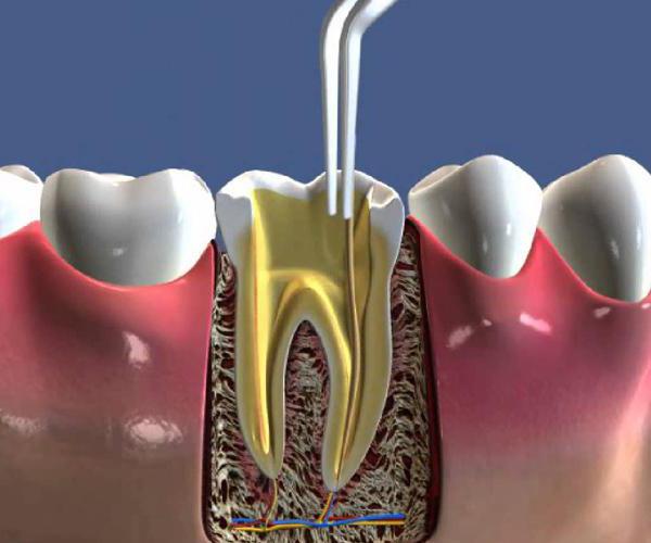 N5-от фофы предвыборные новеллы - Сарматище