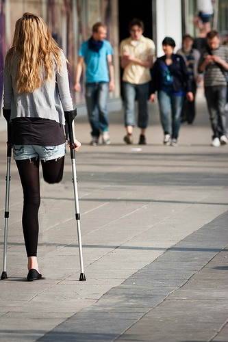 Девушка Без Ноги Знакомство Видео