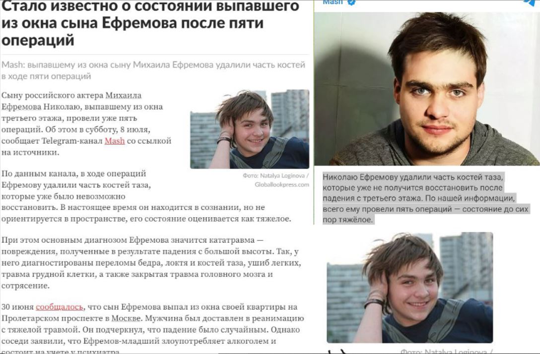 Николаю Ефремову удалили часть костей таза, которые невозможно было восстановить